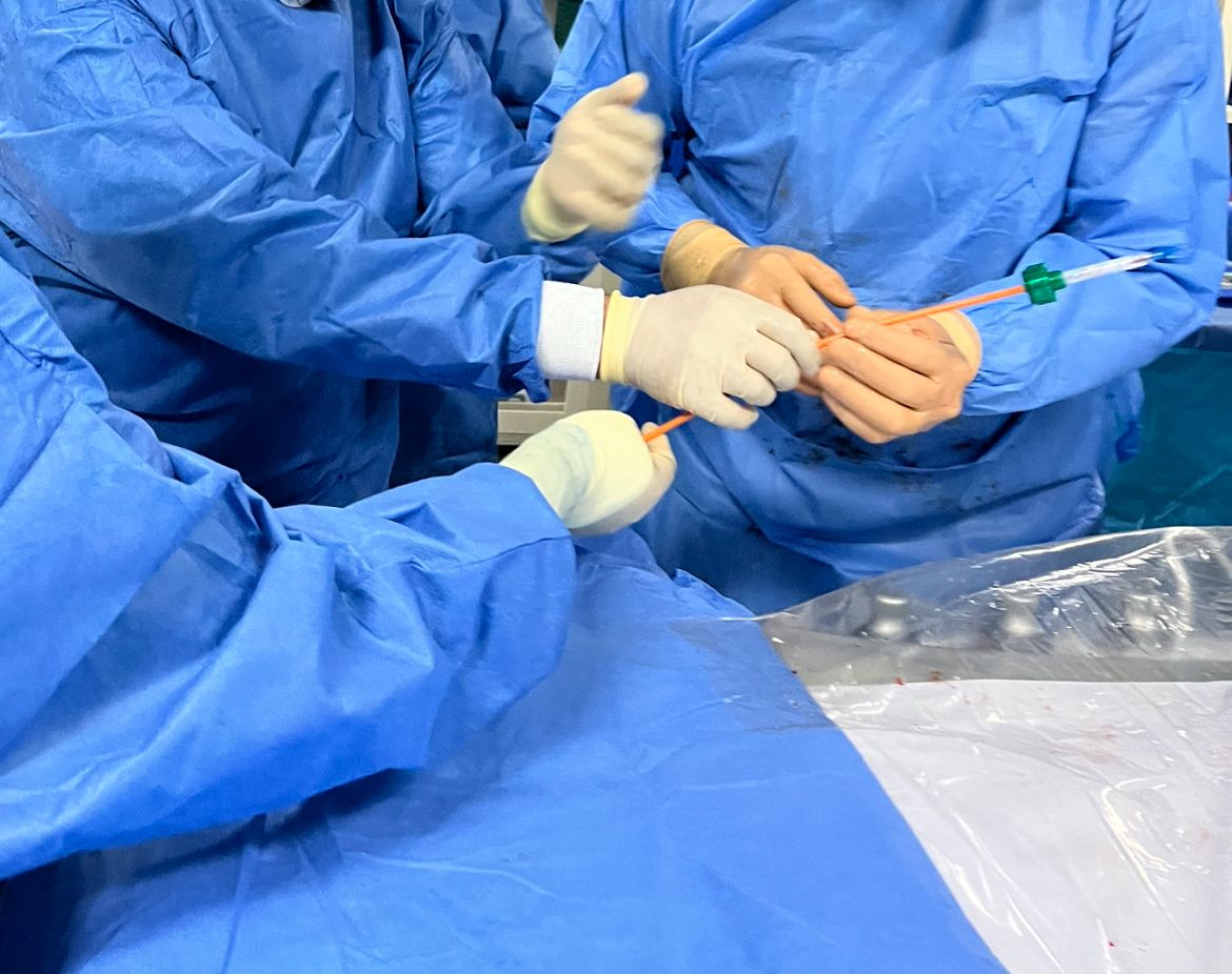 Válvulas Transcatéter TAVI